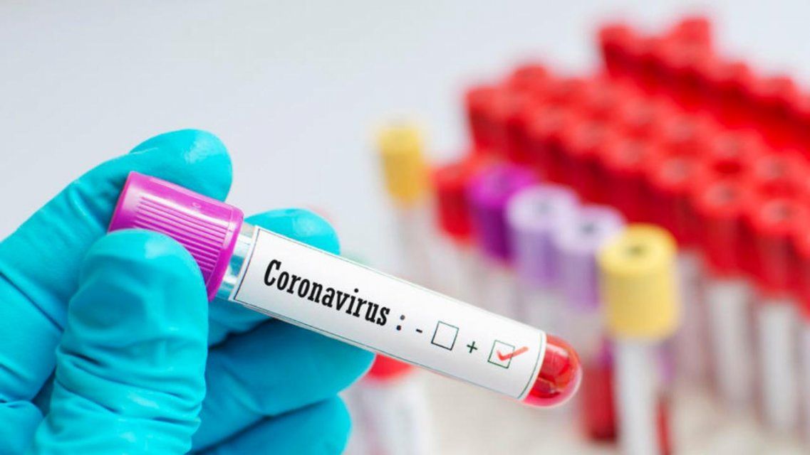 В Орловской области оказались заражены коронавирусом еще 59 человек
