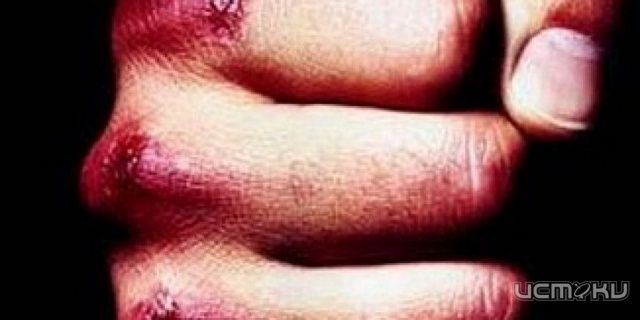 В Корсаковском районе 34-летний мужчина из-за ревности до смерти избил свою сожительницу В Корсаковском районе 34-летний мужчина из-за ревности до смерти избил свою сожительницу