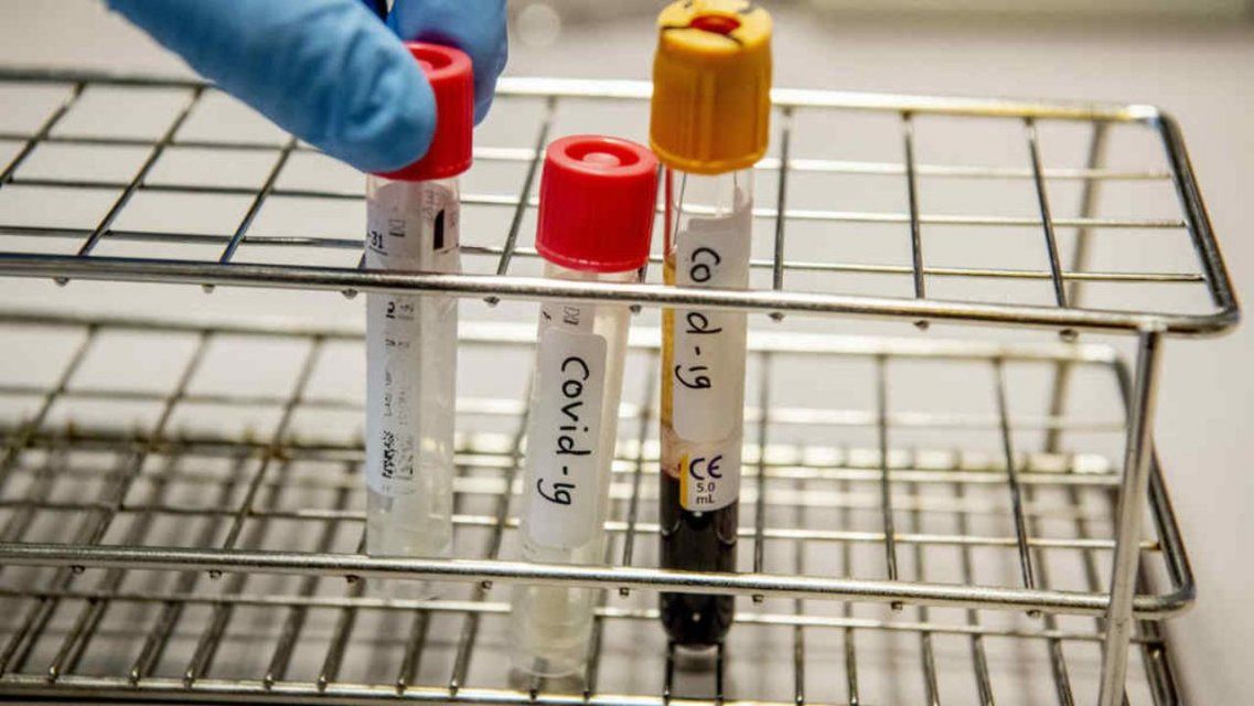 Орловчане могут сдать тест на коронавирус в 5 учреждениях города