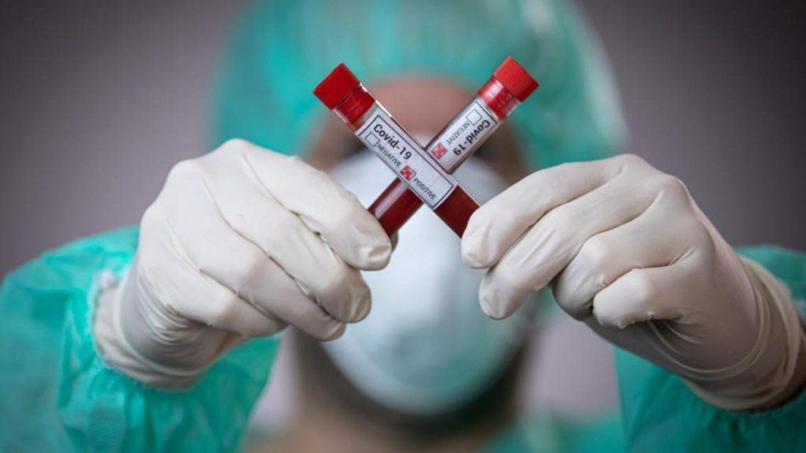 За сутки в Орловской области коронавирус нашли у 31 пациента