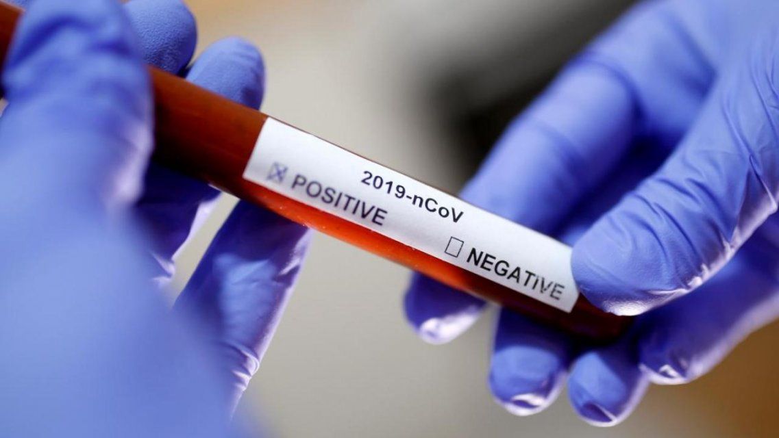 Уже почти 20 тысяч жителей Орловщины проверили на коронавирус