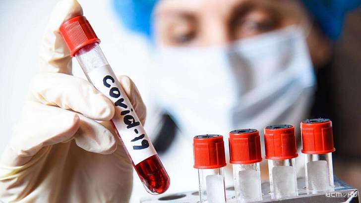 Статистика Орловщины пополнилась двумя смертельными случаями COVID-19 Статистика Орловщины пополнилась двумя смертельными случаями COVID-19