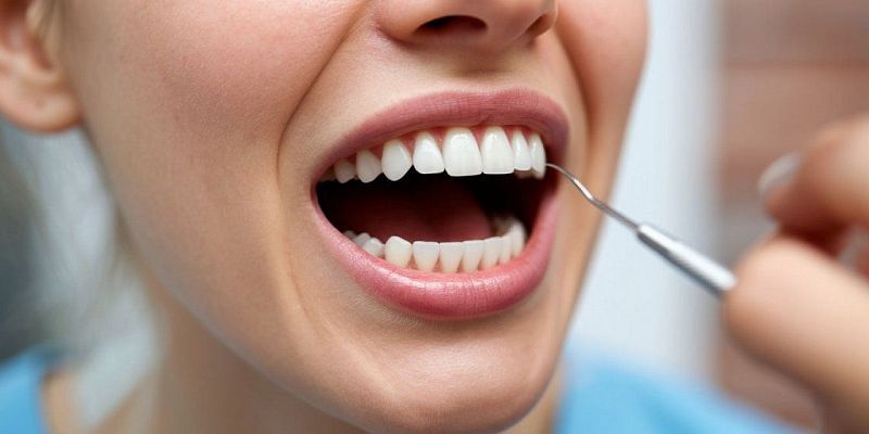 стоматология медицина Имплантация зубов Зубы мудрости: откуда берутся и всегда ли их нужно удалять?