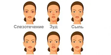 Поллиноз  аллергия Поллиноз на Орловщине: как пережить цветение