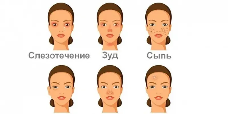 Поллиноз  аллергия Поллиноз на Орловщине: как пережить цветение