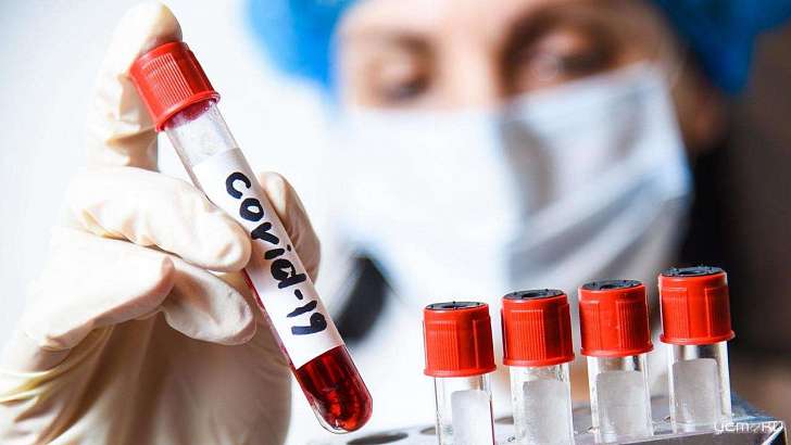 Антирекорд последних месяцев: за сутки у 102 орловчан нашли COVID-19 Антирекорд последних месяцев: за сутки у 102 орловчан нашли COVID-19