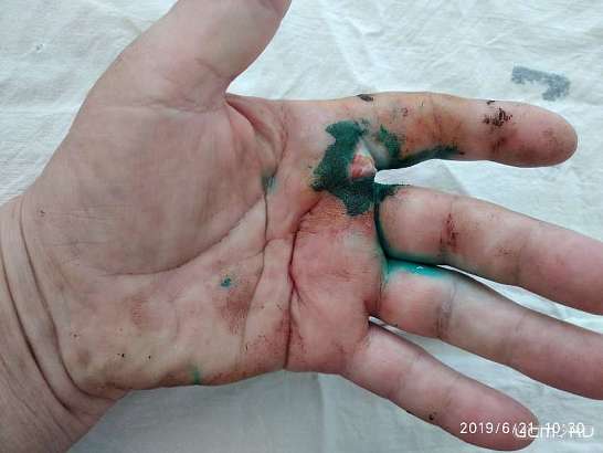 История с нападением терьера на орловчанку получила продолжение История с нападением терьера на орловчанку получила продолжение