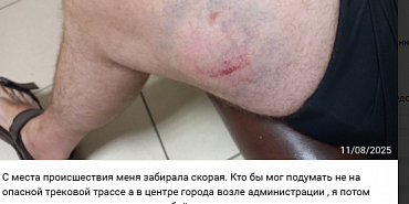 народный корреспондент Полученная в центре города травма принесла орловчанину победу в конкурсе «Народный корреспондент»