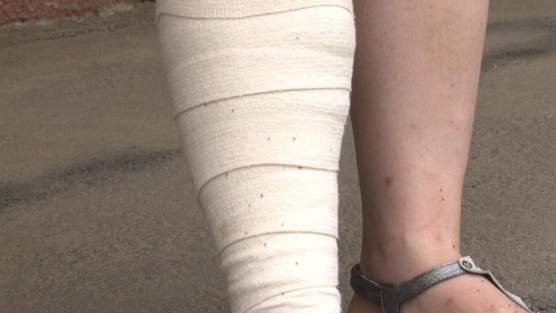 В ее доме поселились «удивительные» соседи: орловчанке мешают жить блохи