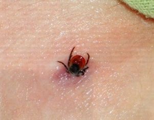 Клещи атакуют жителей Орловской области