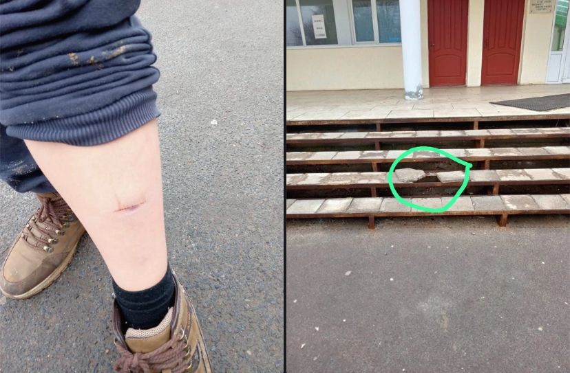 Орловская поликлиника оказалась опасной для пациентов: ребенок получил травму на входе