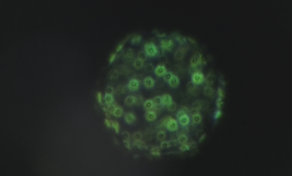 Вредоносные микроорганизмы, вирусы, бактерии могут поставить крест на экспорте зерна. 