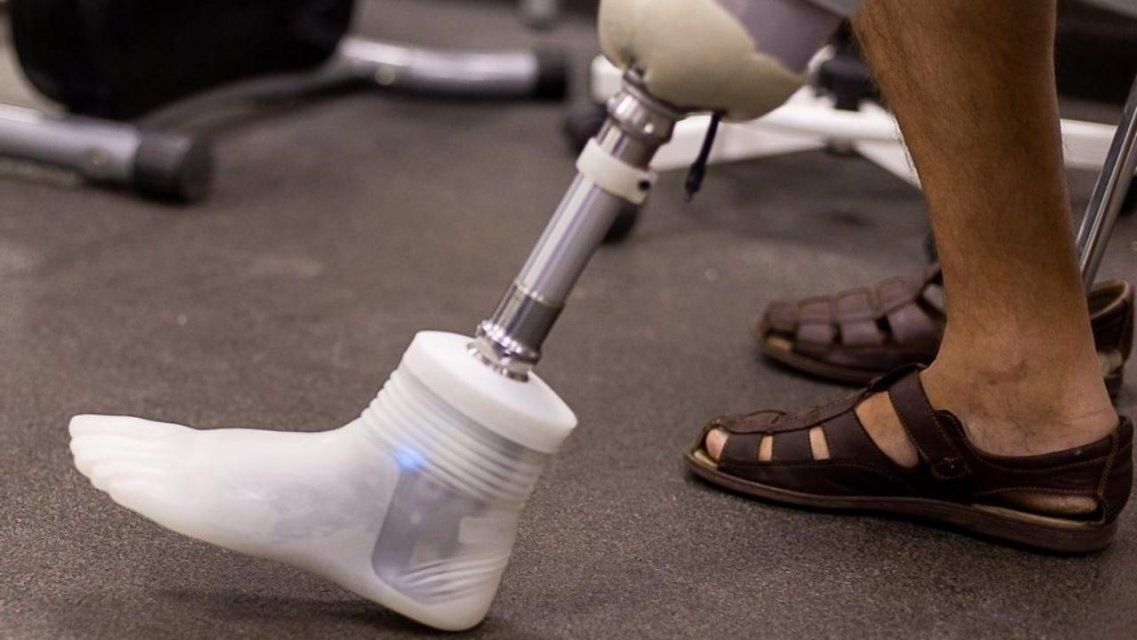 Бизнесмен делал некачественные протезы и похитил около 4,5 миллионов бюджетных рублей