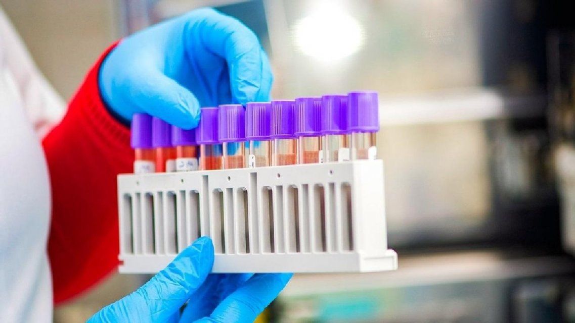 Еще 122 орловчанина заразились, один умер: новые данные по коронавирусу