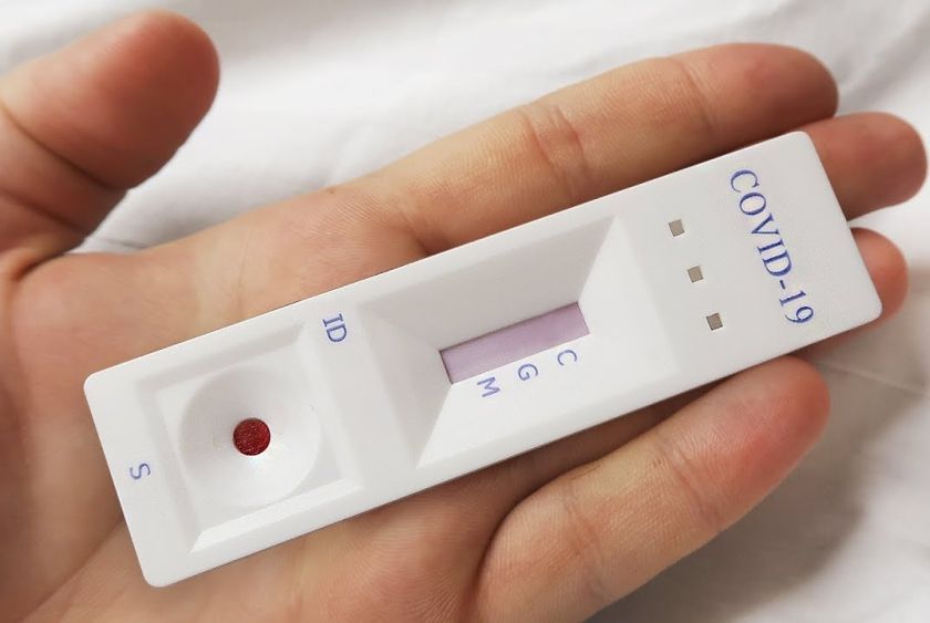 Орловская область ожидает крупную партию экспресс-тестов на ковид