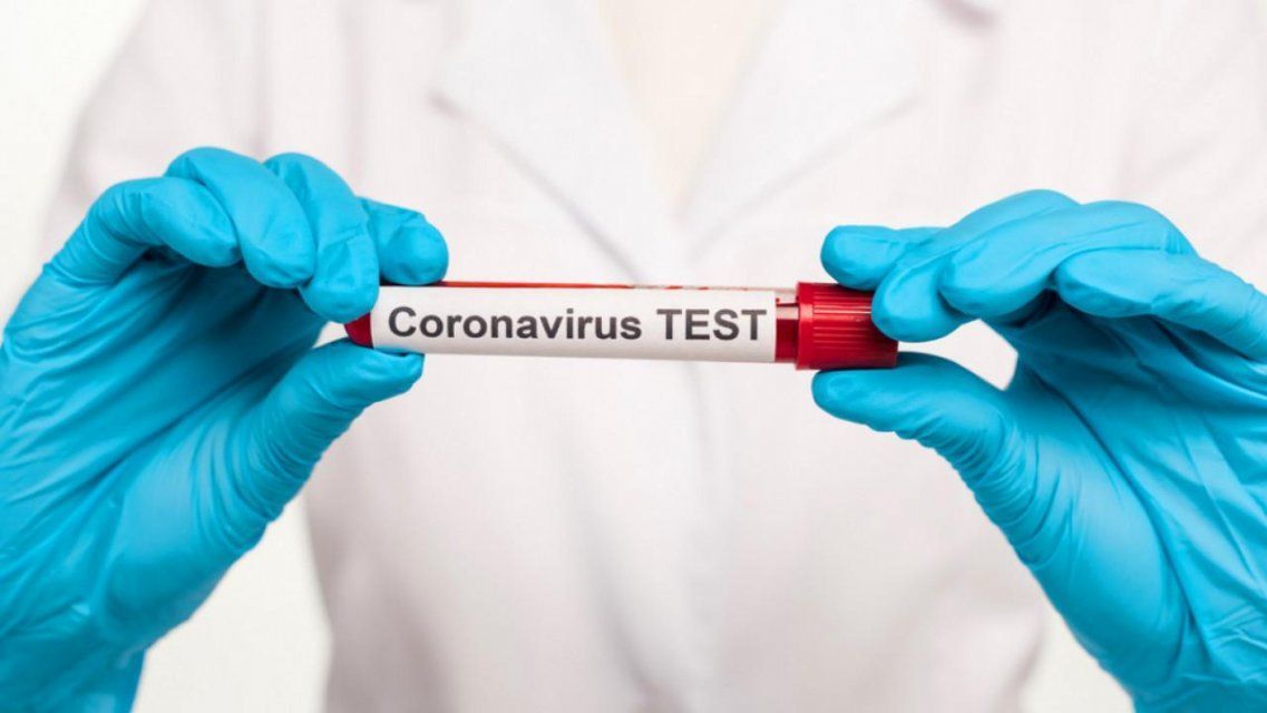 Новые данные: еще у 135 орловчан нашли коронавирус