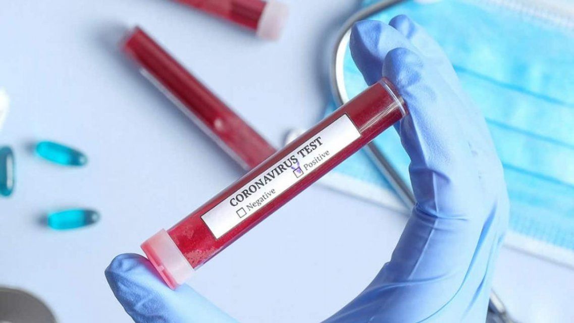 За сутки диагноз COVID-19 подтвердился еще у 58 орловчан