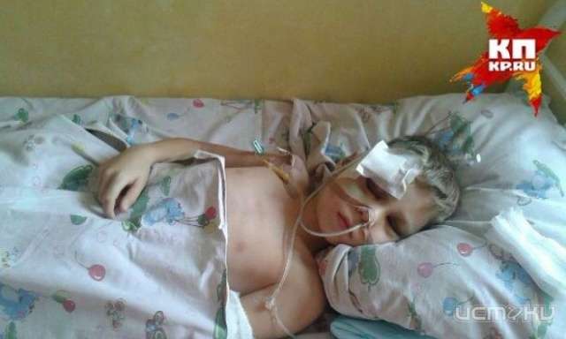 В Орле ребенок получил в школе тяжелую ЧМТ