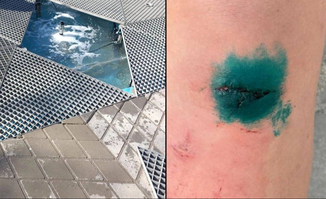 В Ливнах трое детей получили серьезные травмы на сломанном фонтане