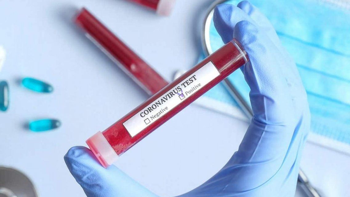 Коронавирус подхватили еще 43 жителя Орловщины