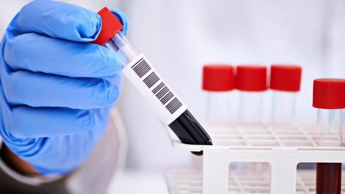 Орловчане жалуются на проблемы с тестами на коронавирус