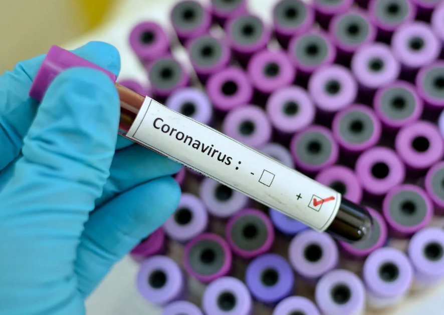 На Орловщине за неделю заболеваемость коронавирусом снизилась на 20%