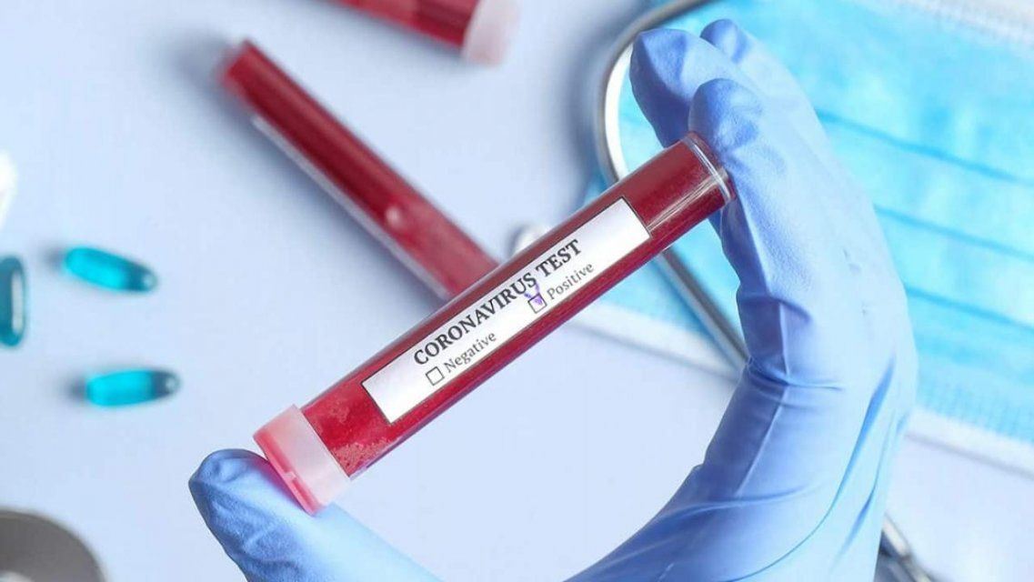 82 орловчанина решили провериться на COVID-19