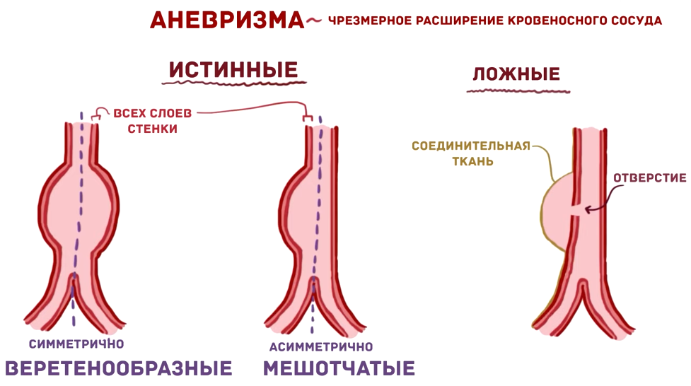 Инновационное лечение в нейрохирургическом центре им. профессора Г.С. Тиглиева "Новые технологии"