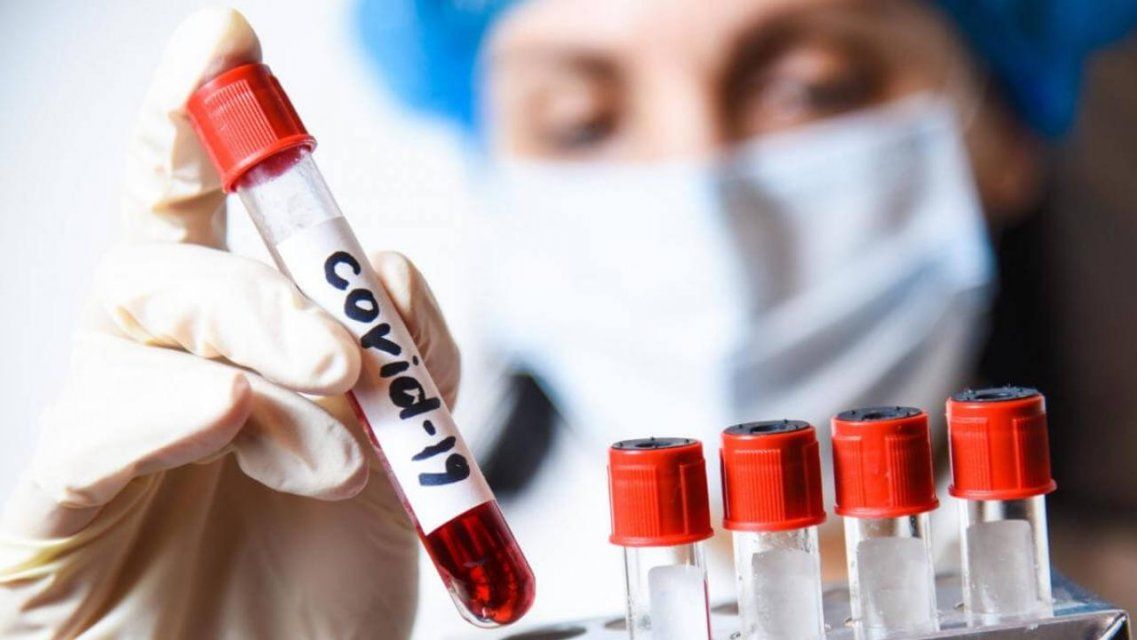 Еще у 46 орловчан подтвердился диагноз COVID-19