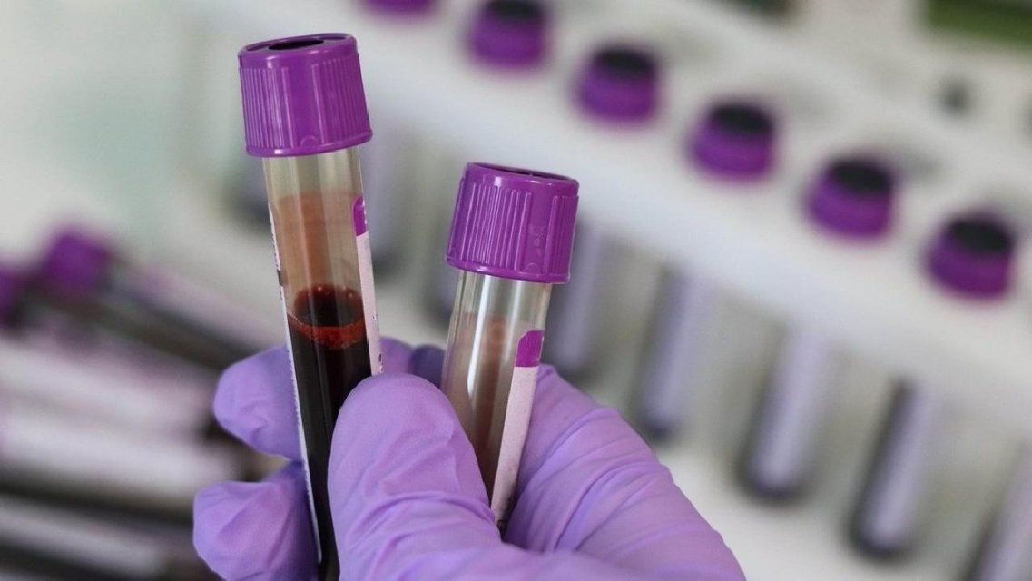 Число заболевших коронавирусом достигло на Орловщине 4318