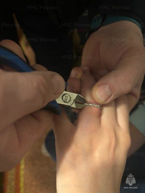 Орловчанка смогла избавиться от кольца только с помощью спасателей