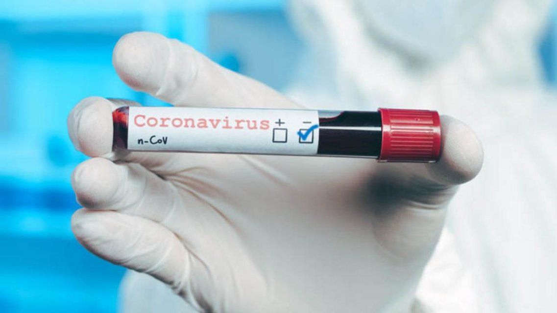 Губернатор призвал не допускать к работе отпускников без теста на COVID-19