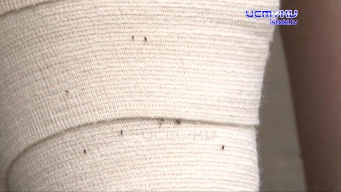 Блохи превратили жизнь орловчанки в кошмар, а УК на помощь не спешит