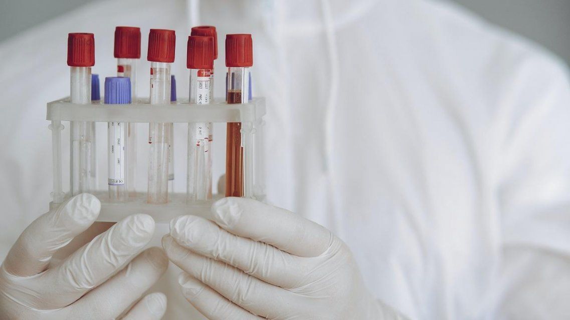 Свежие данные: еще у 141 человека на Орловщине обнаружили коронавирус