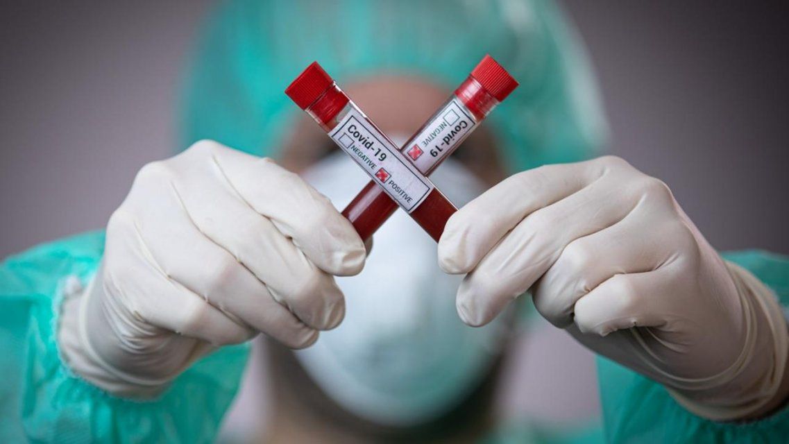 В Орловской области диагноз COVID-19 подтвердился еще у 65 человек