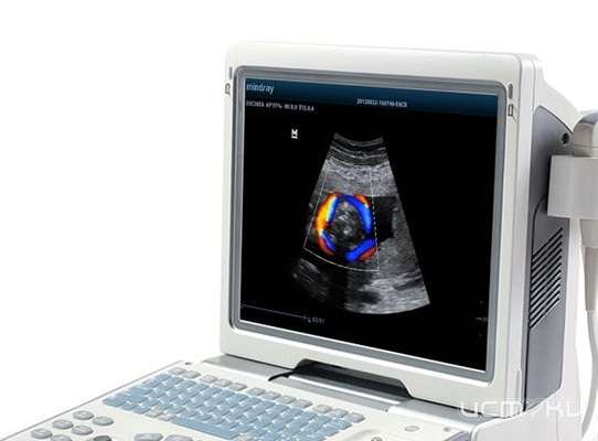 В Орле в больницу им. Боткина поставят современное оборудование
