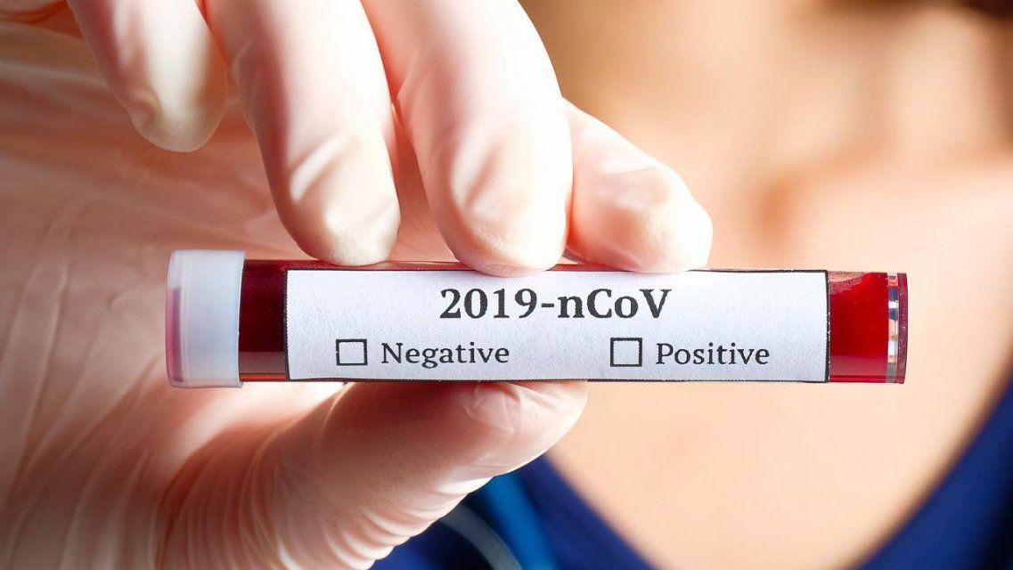 Еще 41 орловчанин подхватил коронавирус