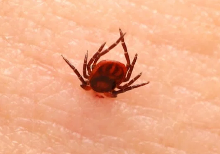 Более 300 орловчан пострадали от укусов клещей