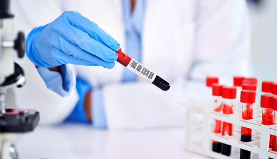 Как готовиться к сдаче анализов на гепатит