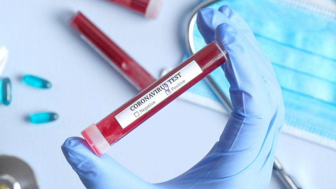 Еще двое пациентов с COVID-19 умерли в Орловской области