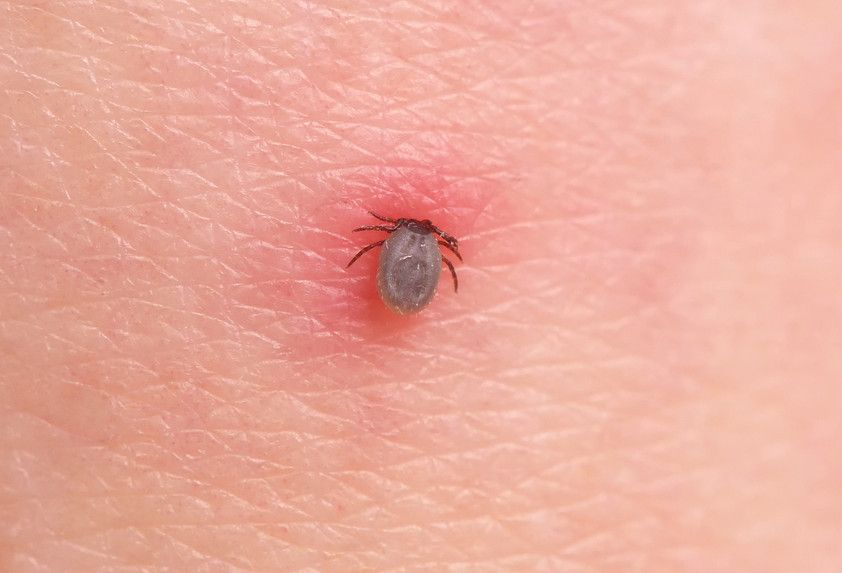 Двое жителей Орловщины заразились болезнью Лайма