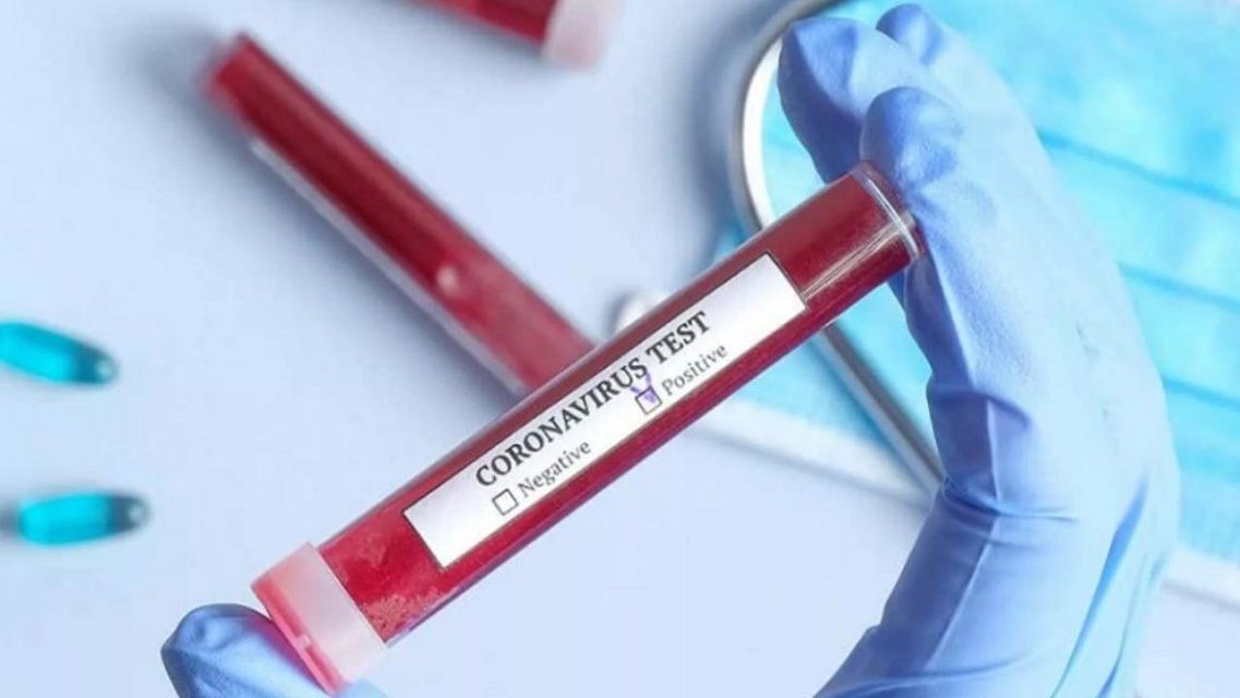 Число зараженных коронавирусом на Орловщине превысило четыре сотни