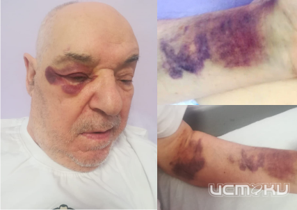 Прокуратура и СК проводят проверку по сообщению об избиении пациента в орловской больнице