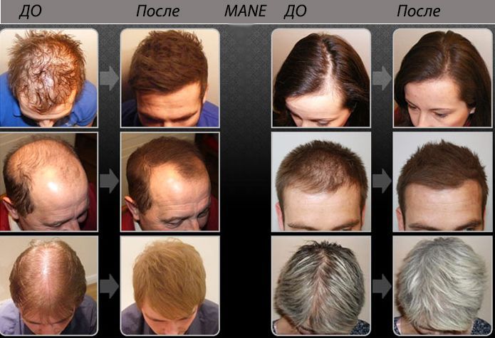 Загустители для волос: особенности и преимущества использования