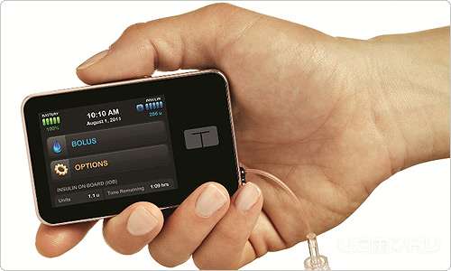 В Орловской области впервые в России стартует выпуск инсулиновой помпы