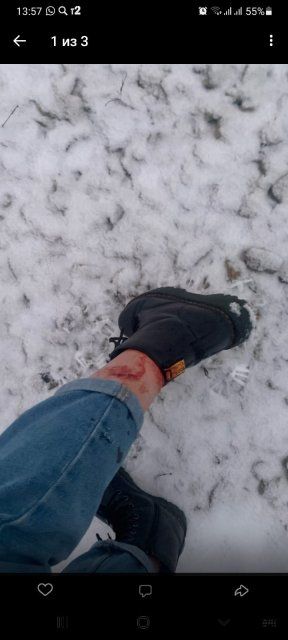 В Железнодорожном районе собаки покусали детей