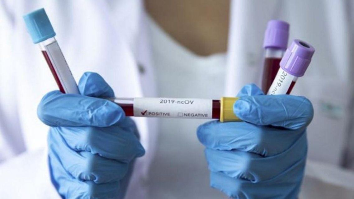 На Орловщине умер еще один пациент с COVID-19