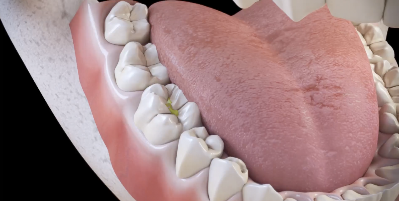 Что нужно знать о пульпите, чтобы сохранить здоровье зубов