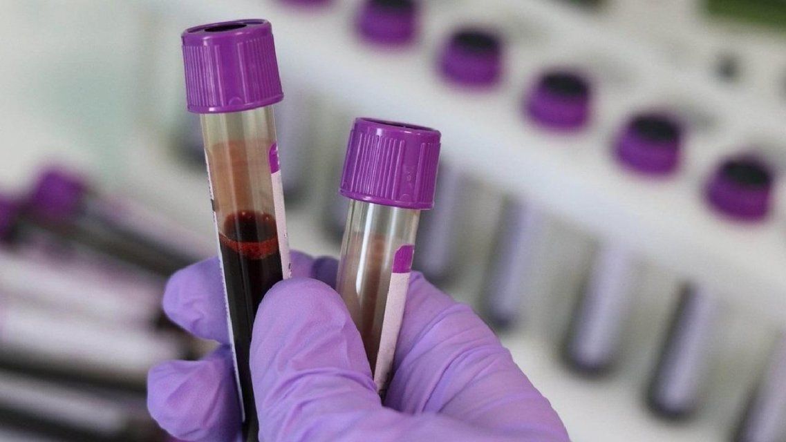 В Орловской области оказались заражены коронавирусом еще 38 человек