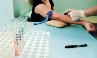 В Орловской области сейчас зарегистрировано 1700 ВИЧ-инфицированных